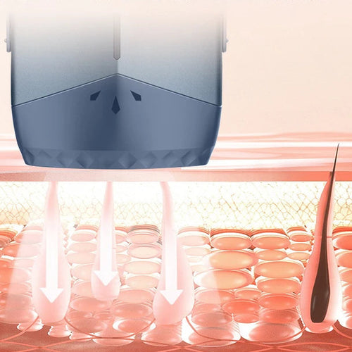 ArcticTouch™ IPL Pro